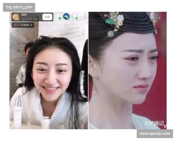 景甜整容事故引发关注:面部僵硬肿胀,眼睛缩水成悲伤蛙(景甜整容呀 对比) 景甜整容事故引发关注:面部僵硬肿胀,眼睛缩水成悲伤蛙(景甜整容呀 对比)